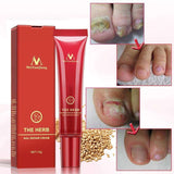 Hand And Foot Nail Repair Cream