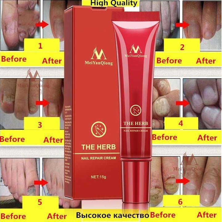 Hand And Foot Nail Repair Cream